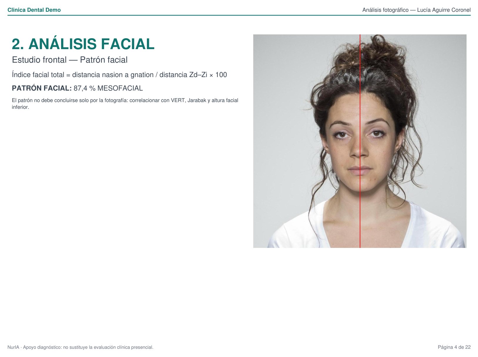 Análisis facial con medidas