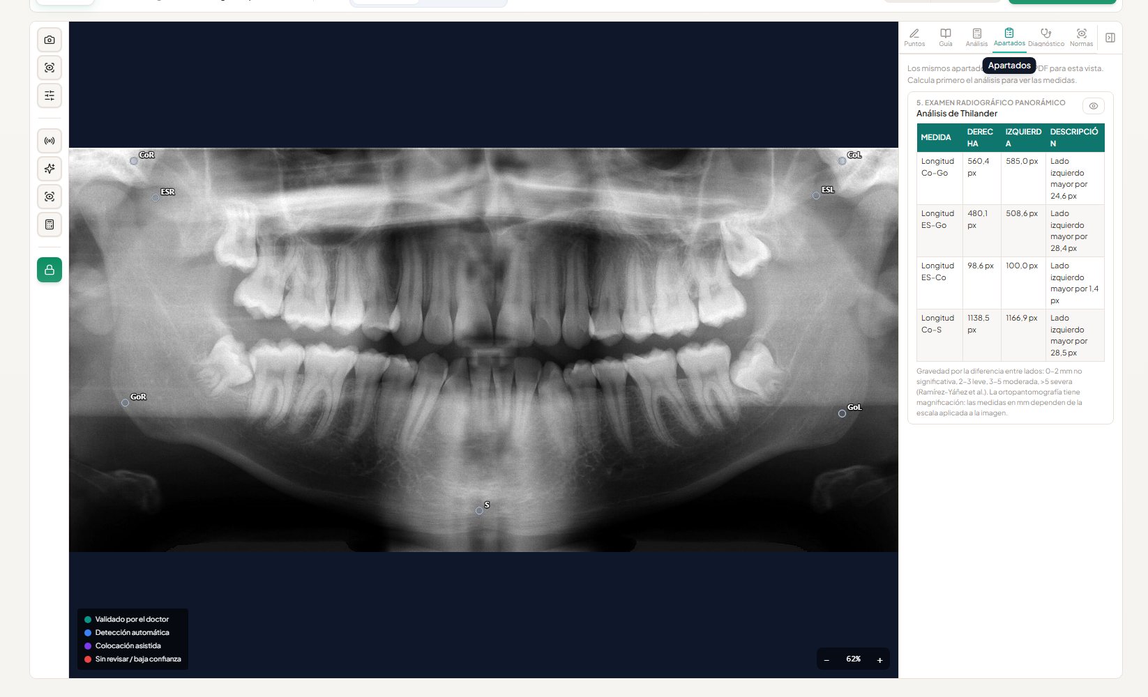 Radiografía panorámica en el módulo