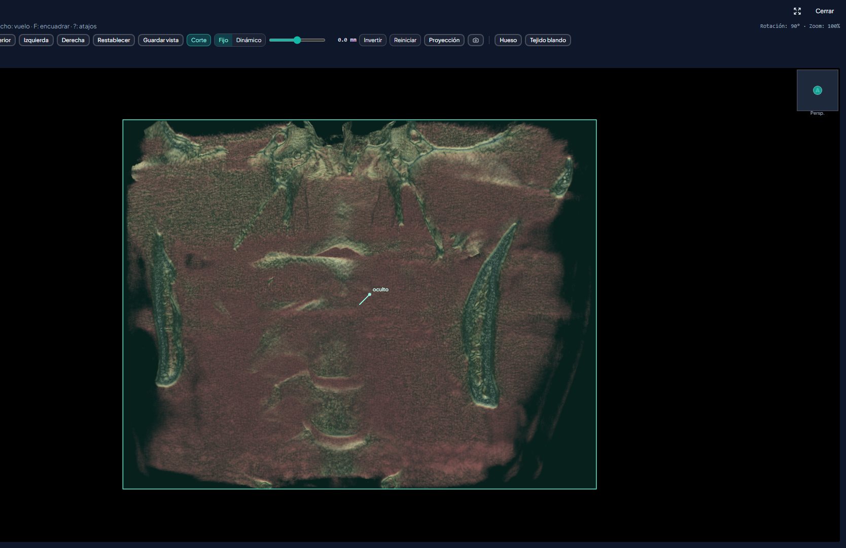 Vista 3D con estructuras óseas